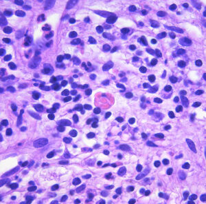 Microscopic view of biological cells with a purple color scheme.