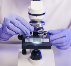 Gloved hands holding a white microscope for pathology analysis.